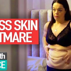 My Excess Skin NIGHTMARE (Channel 4) | Medical Documentary | Reel Truth Science