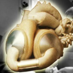 The Artificial Heart: Where did it come from? | Stuff of Genius